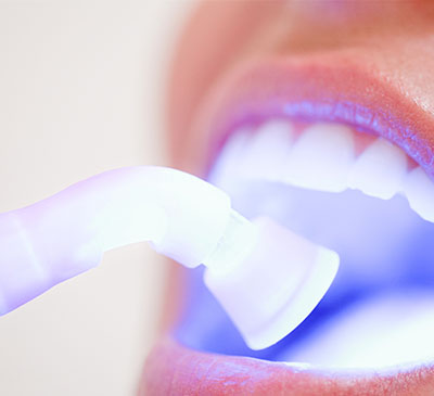 Global Dental Lights Market 2019-2023